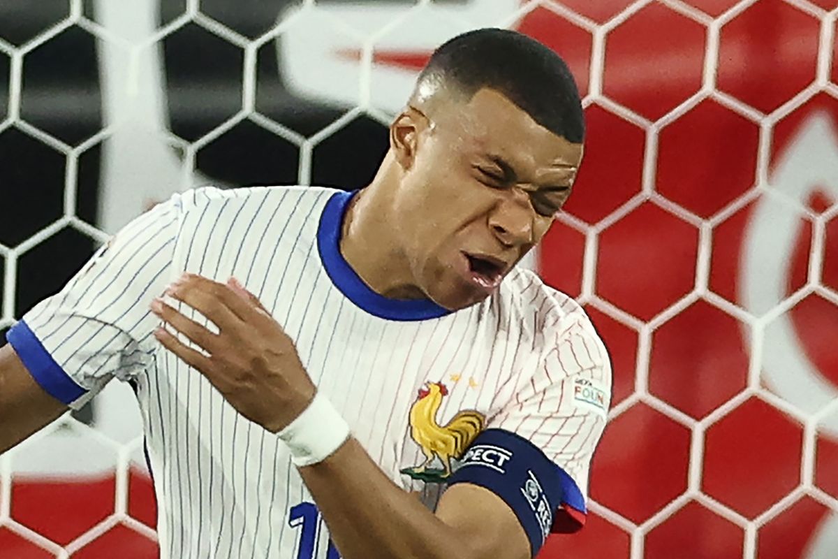 Mbappé se fracturó la nariz, pero sigue en la Copa: ¿Jugará con mascarilla de tortuga ninja?