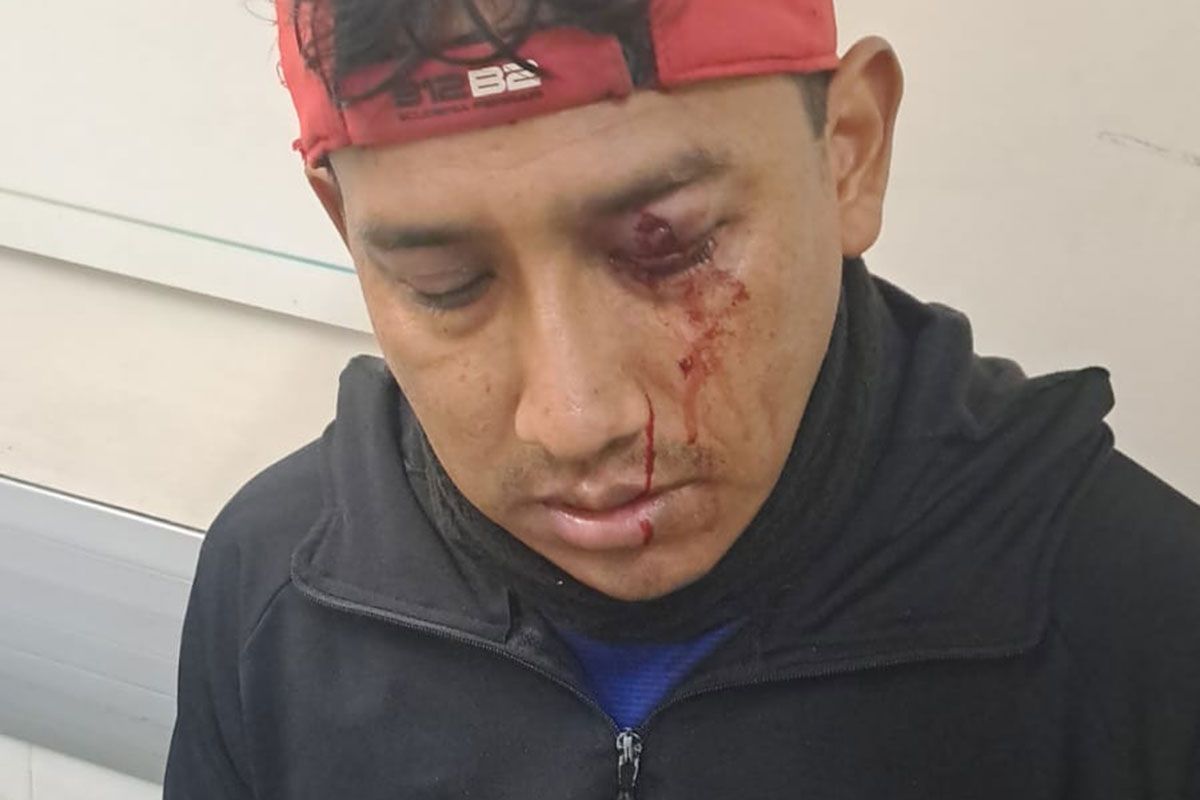 Varios heridos en la represión de una feria del Bajo Flores